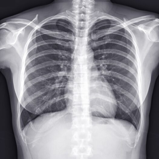Bachelor of Radiography